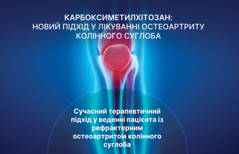 Карбоксиметилхітозан у лікуванні остеоартриту колінного суглоба: новий підхід у відділенні ортопедії клініки CitiDoctor